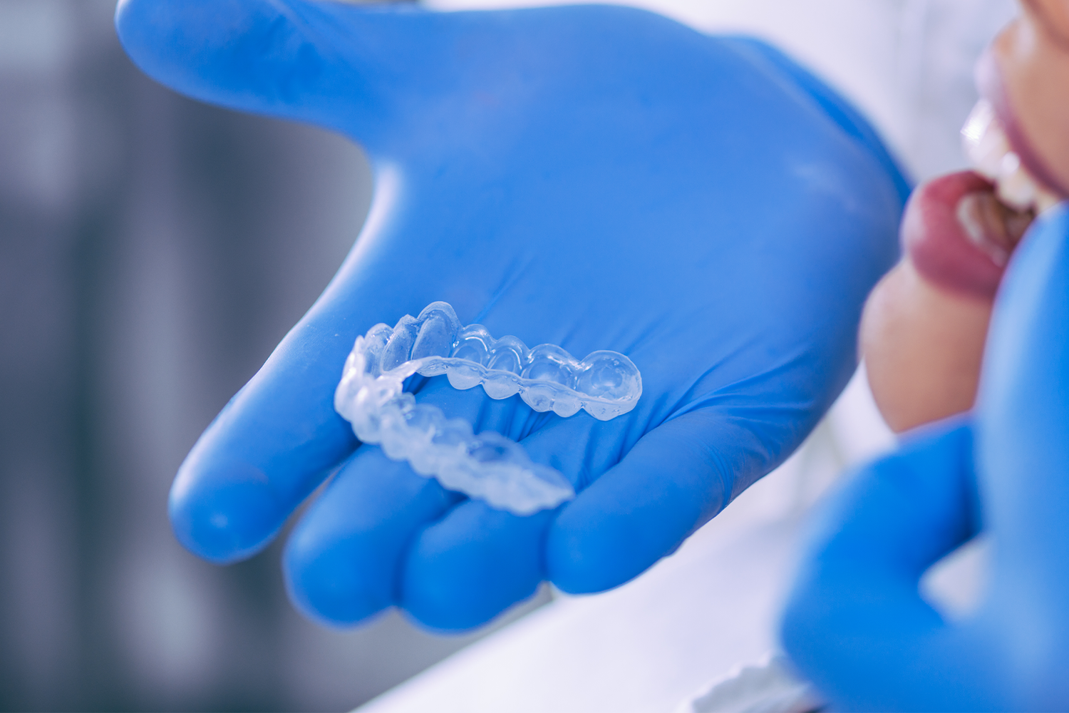 dental-professional-showing-clear-aligner-to-patie-2026-03-10-03-09-39-utc