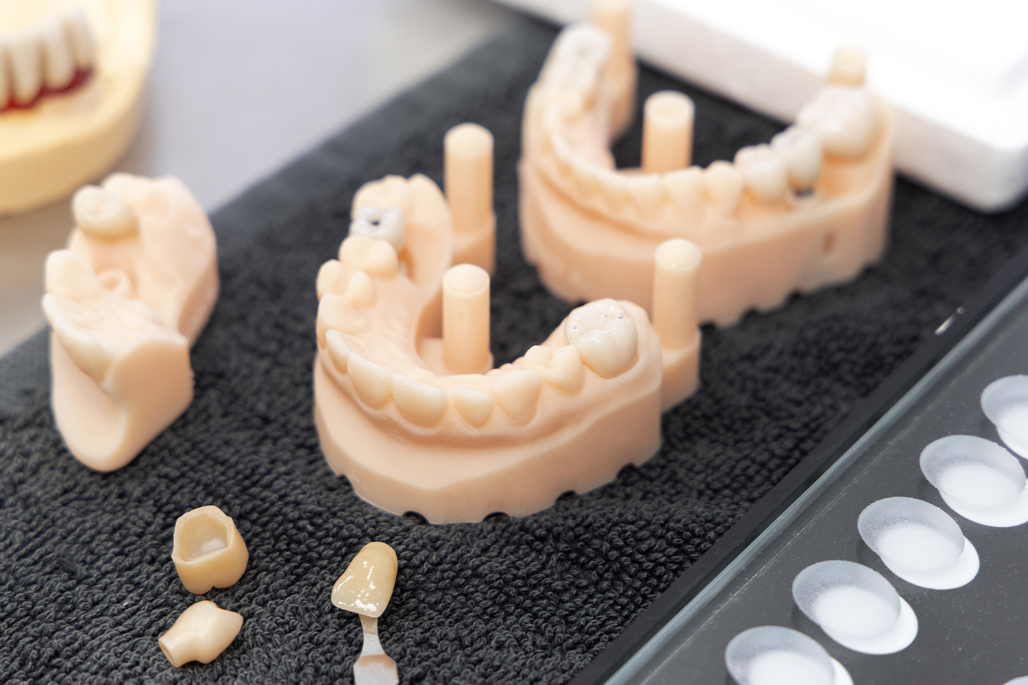 dental-prosthetics-in-a-dental-laboratory-2026-03-26-23-58-05-utc