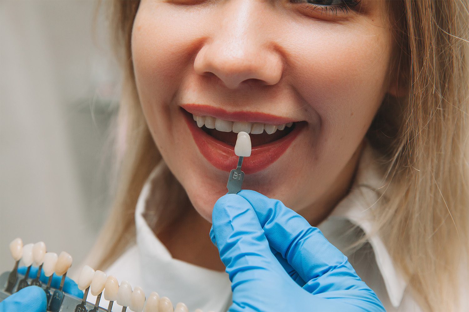 woman-smiles-during-teeth-whitening-process-at-den-2026-09-23-21-09-51-utc