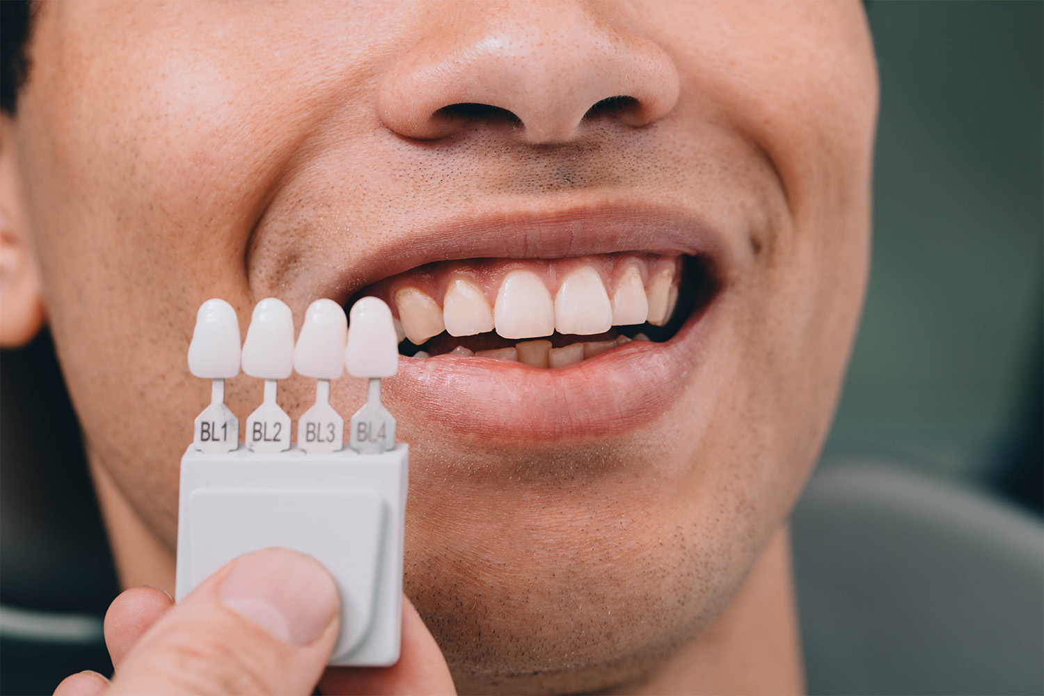 young-man-smiling-with-teeth-shade-guide-2026-09-22-13-17-09-utc