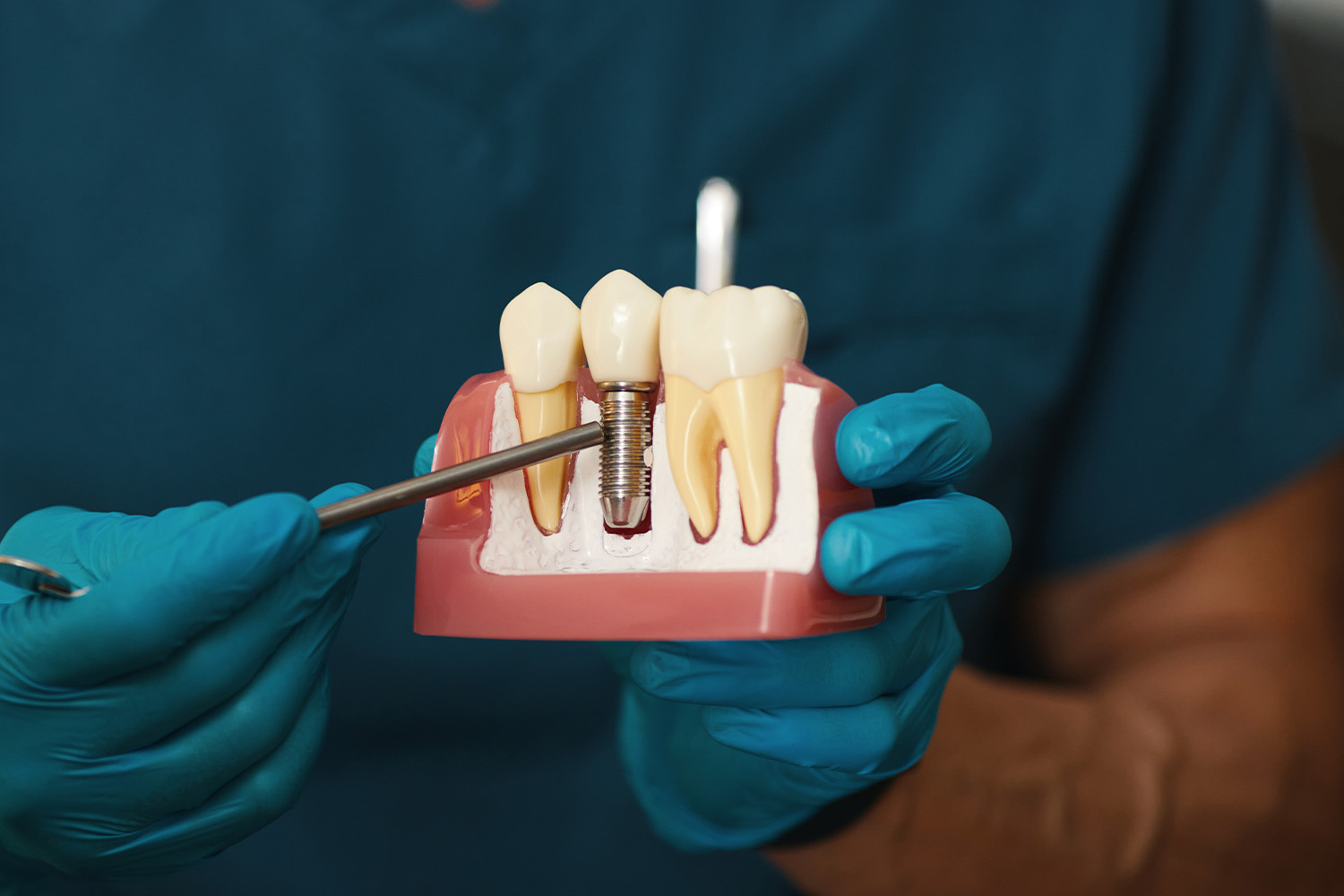 dentist-holding-dental-implant-model-in-hand-2026-09-23-10-40-23-utc